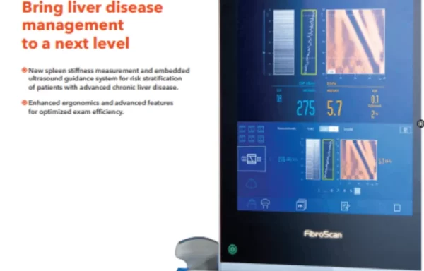 FibroScan® Expert 630